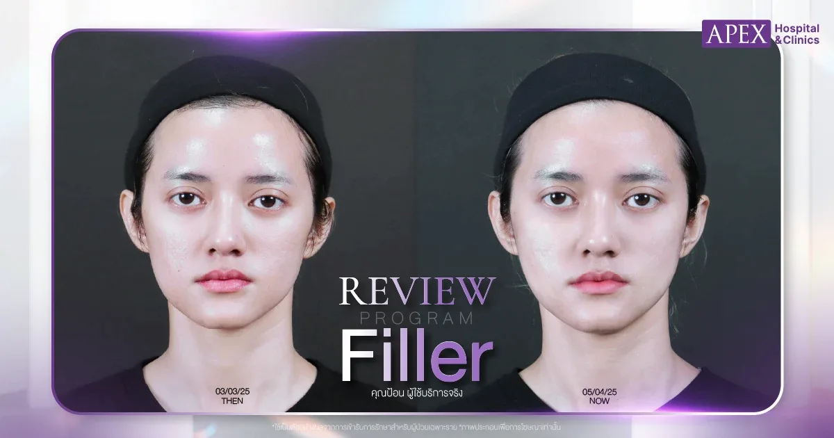 รีวิวแก้แก้มตอบ