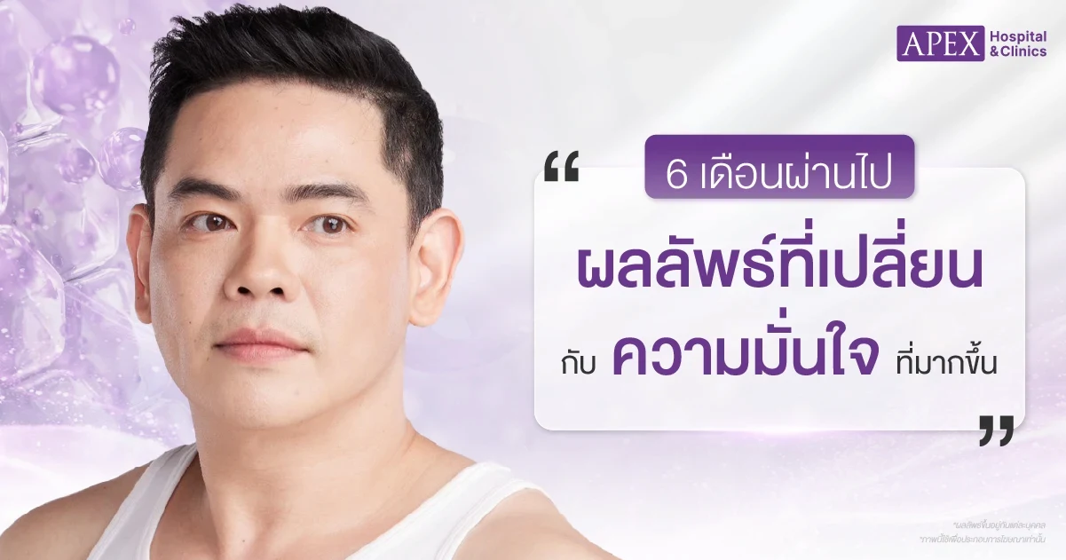 รีวิวดูดไขมันกรอบหน้า