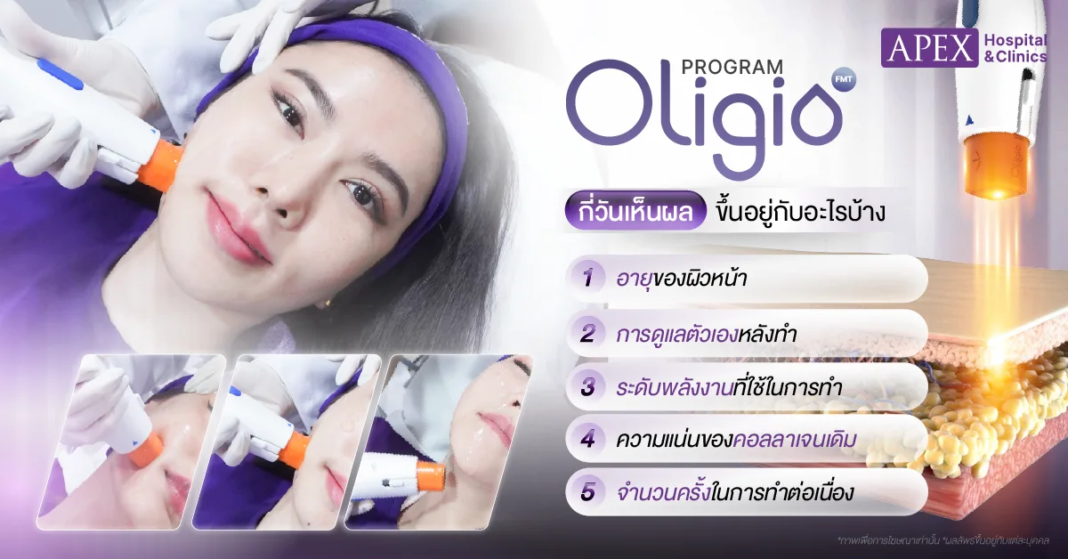 Oligio กี่วันเห็นผล ขึ้นอยู่กับอะไรบ้าง