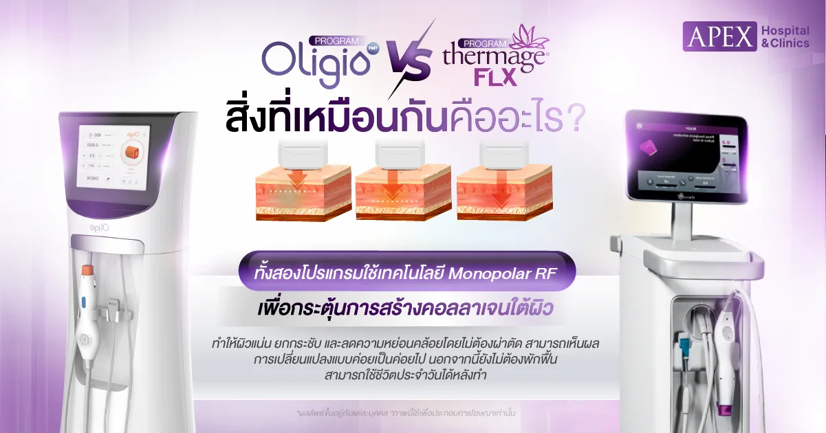 Oligio vs Thermage