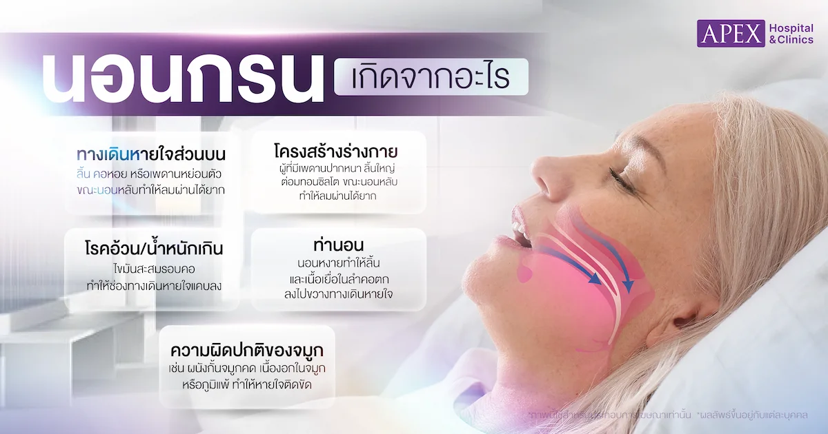 นอนกรน เกิดจาก