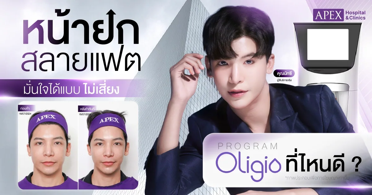oligio ที่ไหนดี