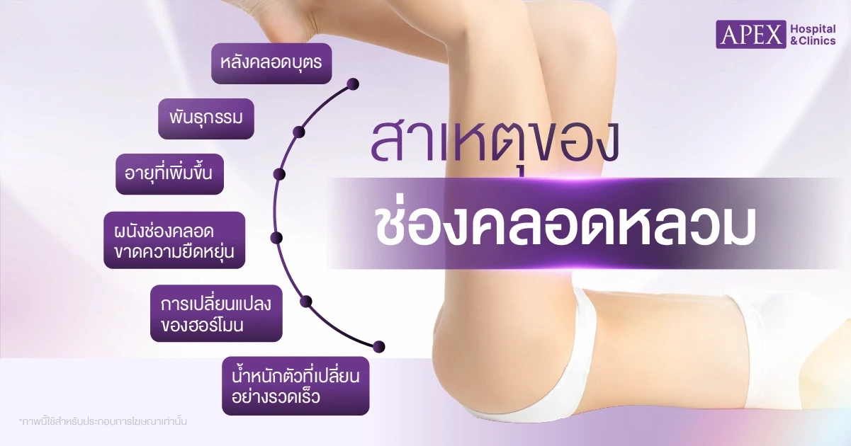 สาเหตุของช่องคลอดหลวม