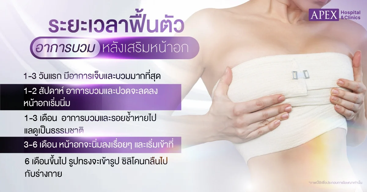 ระยะเวลาพักฟื้นอาการบวมหลังเสริมหน้าอก