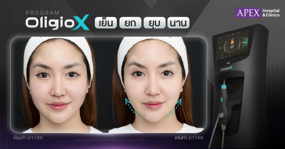 รีวิวโปรแกรม OligioX ที่ APEX
