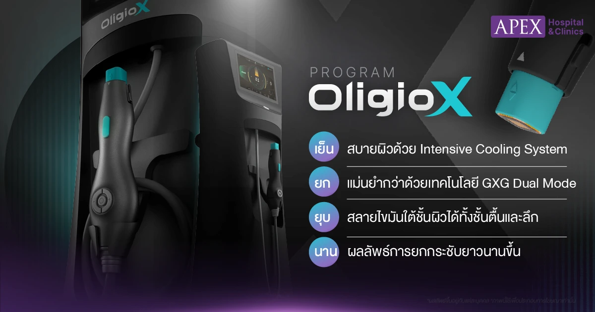 โปรแกรม OligioX คืออะไร