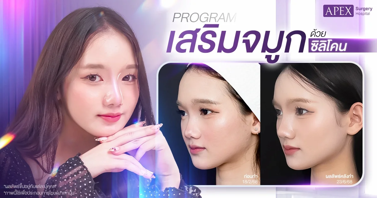 รีวิว จมูกทรงตั๊กแตน