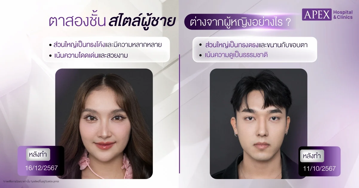 ตาสองชั้นผู้ชายแตกต่างจากผู้หญิงอย่างไร