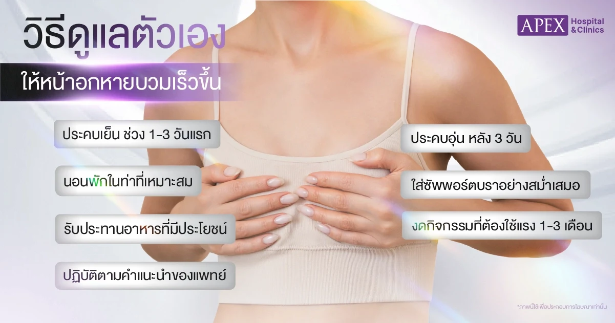 วิธีดูแลตัวเองให้การเสริมหน้าอกหายบวมเร็วขึ้น