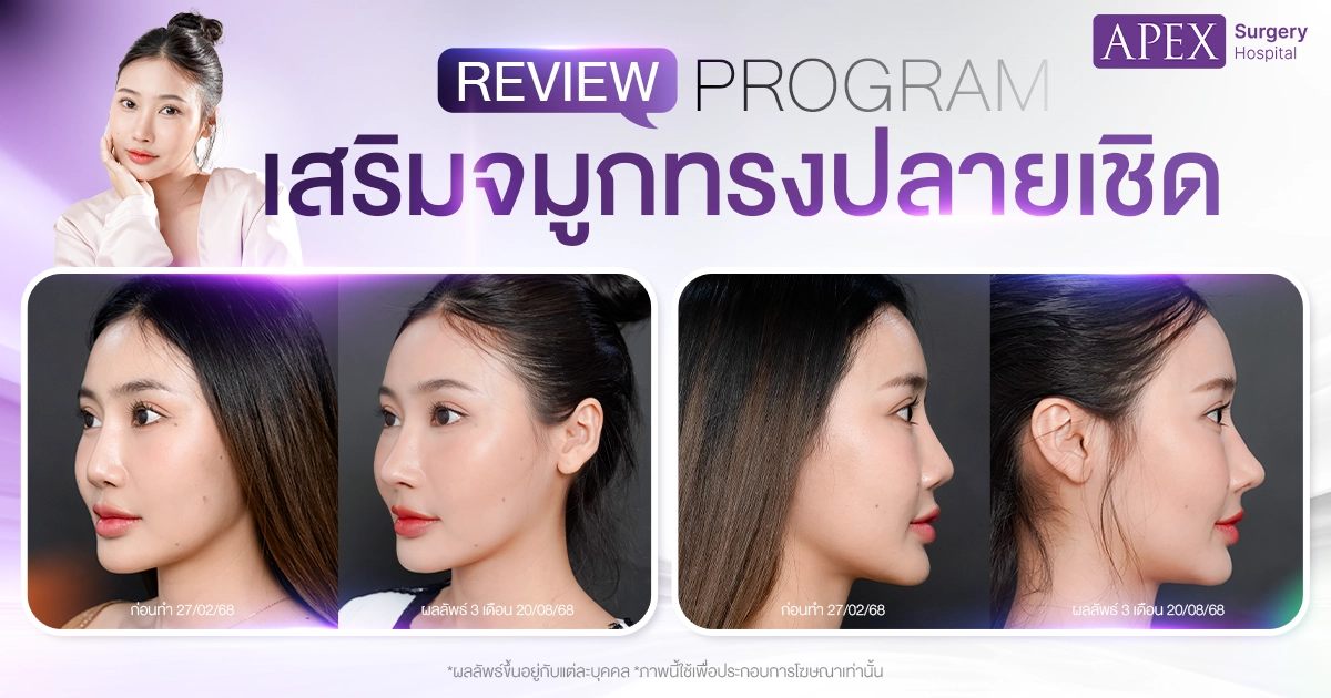 รีวิว จมูกทรงสโลปปลายเชิด