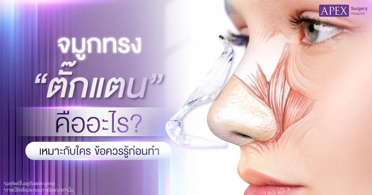 จมูกทรงตั๊กแตน คืออะไร