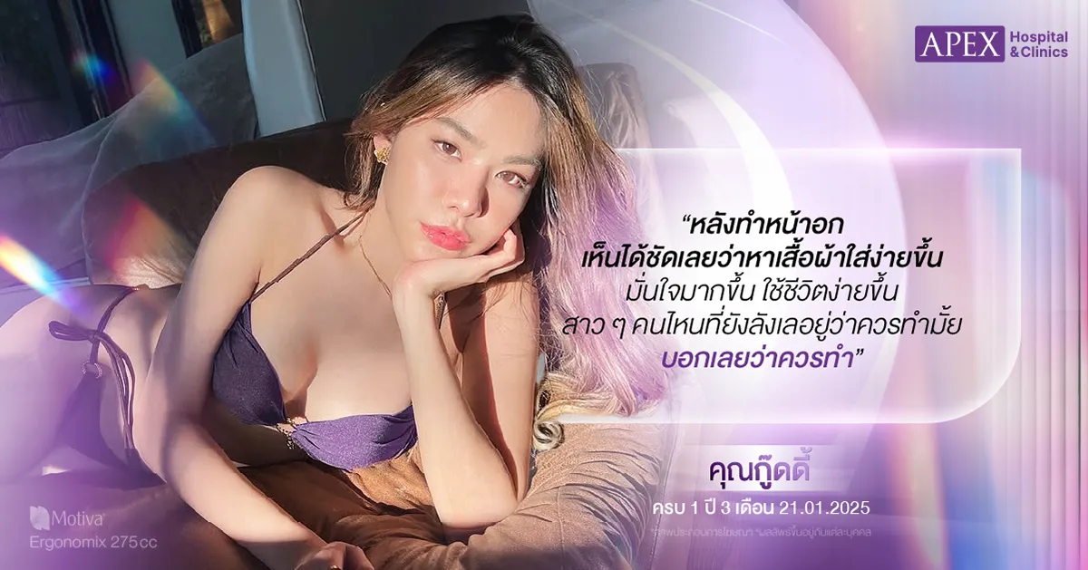 รีวิวความรู้สึกคุณกู๊ดดี้ หลังเสริมหน้าอก