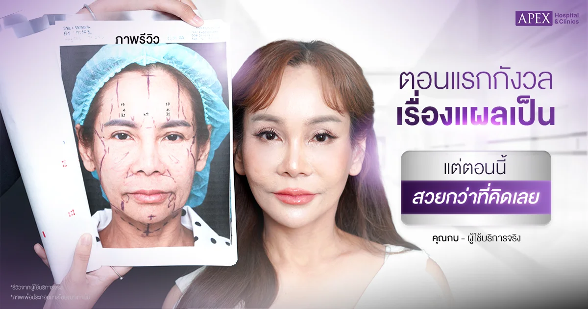 แผลผ่าตัดดึงหน้า