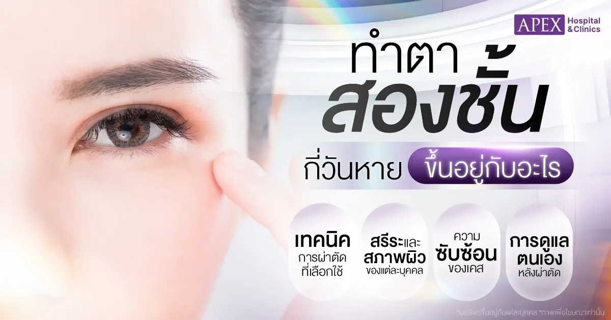 ทำตาสองชั้นกี่วันหาย ขึ้นอยู่กับอะไร