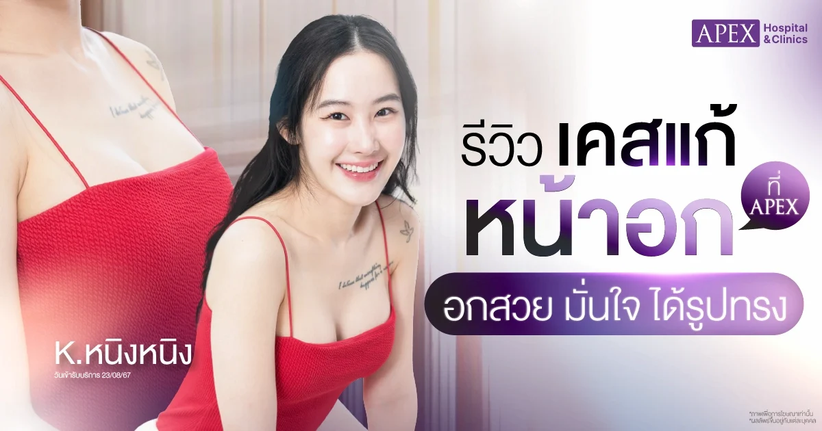 รีวิวแก้หน้าอก ซิลิโคน Motiva JOY