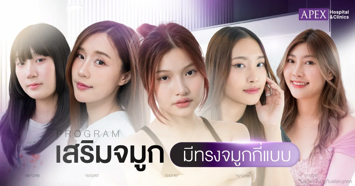 เสริมจมูก มีทรงจมูกกี่แบบ