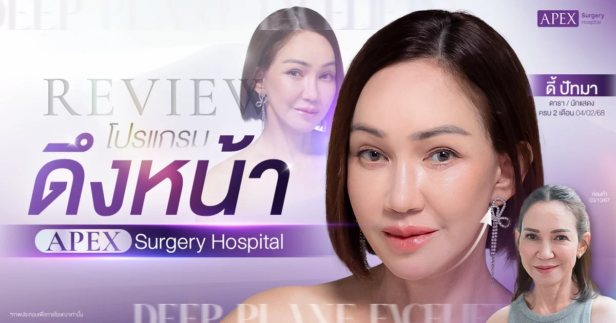 รีวิวดึงหน้าชั้นลึก Apex Surgery