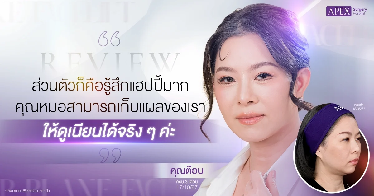 รีวิวดึงหน้า คุณต๊อบ