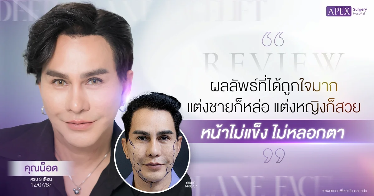 รีวิวดึงหน้า คุณน็อต