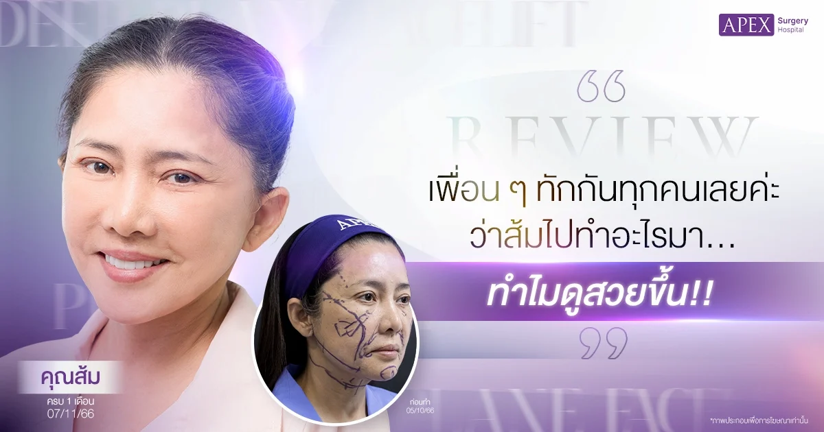 รีวิวดึงหน้า คุณส้ม