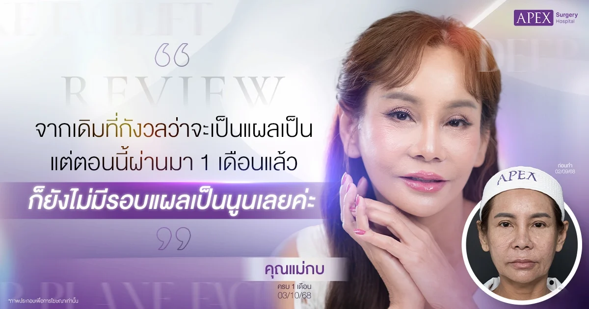 รีวิวดึงหน้า คุณแม่กบ