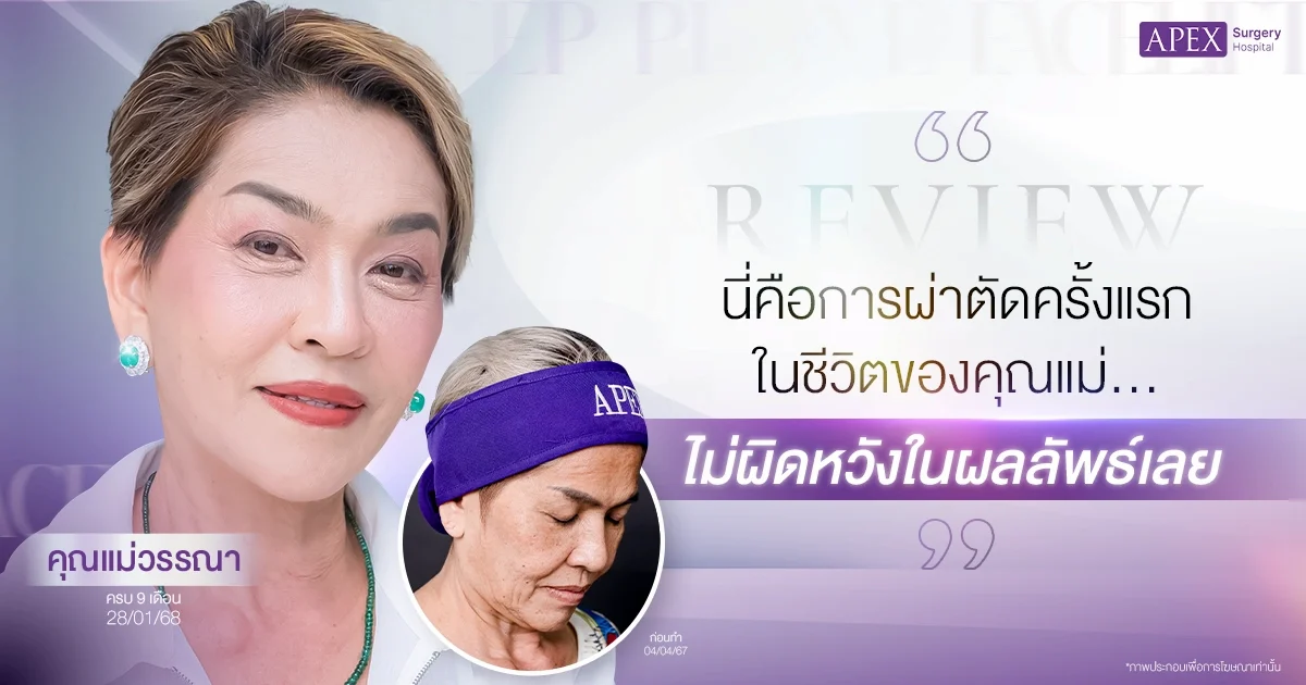 รีวิวดึงหน้า คุณแม่วรรณา