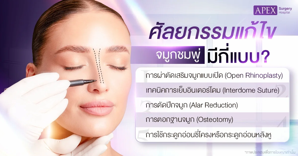 เทคนิคแก้จมูกชมพู่ มีอะไรบ้าง