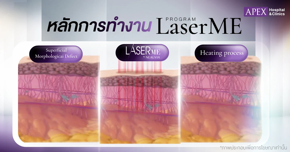 หลักการทำงาน LaserME