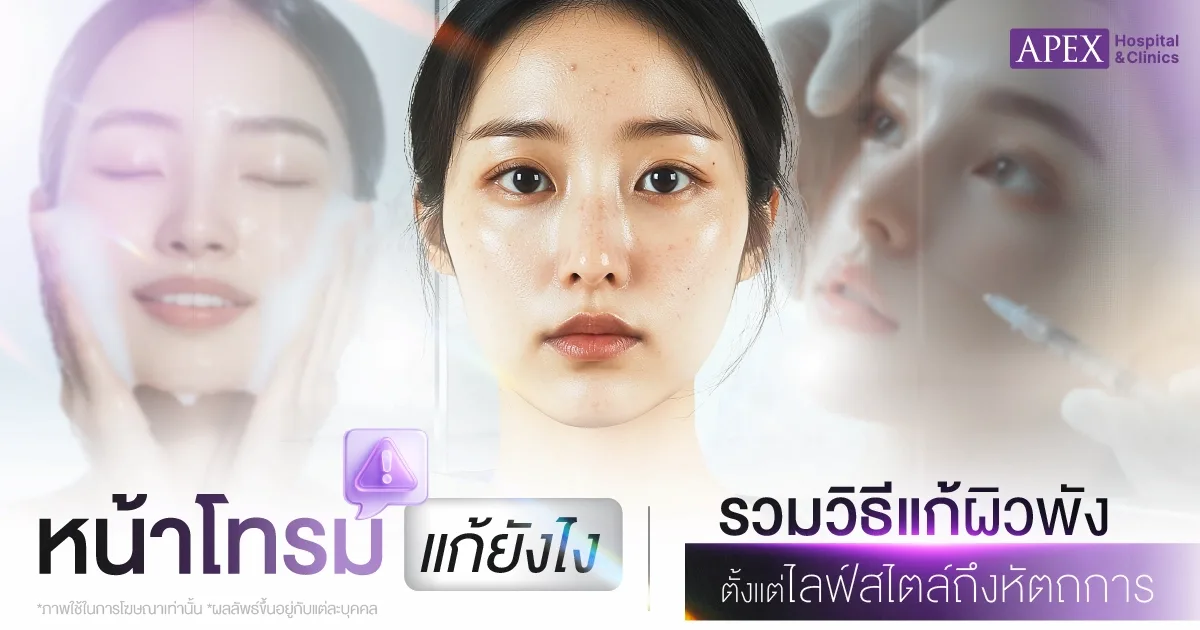 หน้าโทรมแก้ยังไง