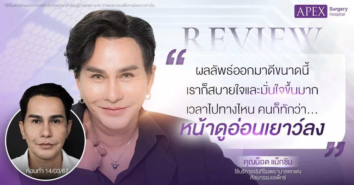 เคยศัลยกรรมดึงหน้ามาแล้ว ดึงอีกได้ไหม