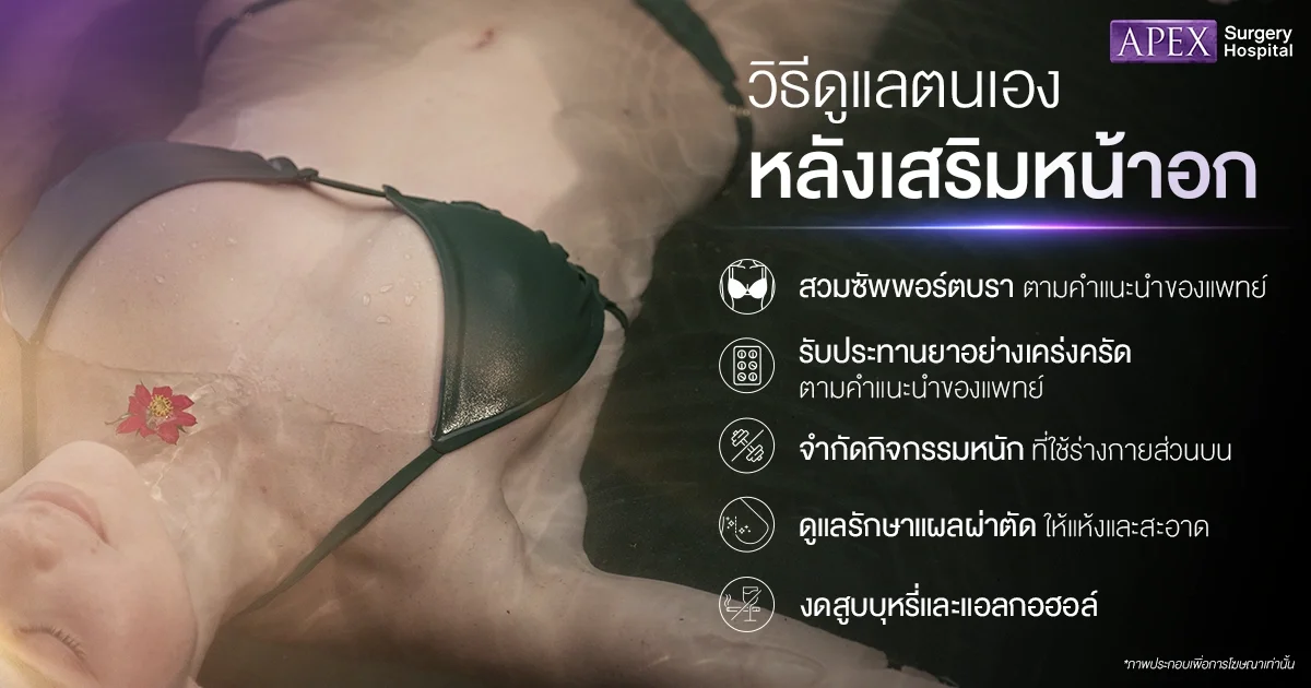 หลังทำ Motiva Preserve