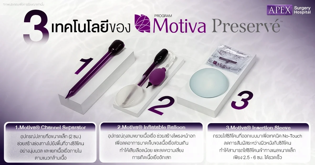 เทคโนโลยี Motiva Preserve