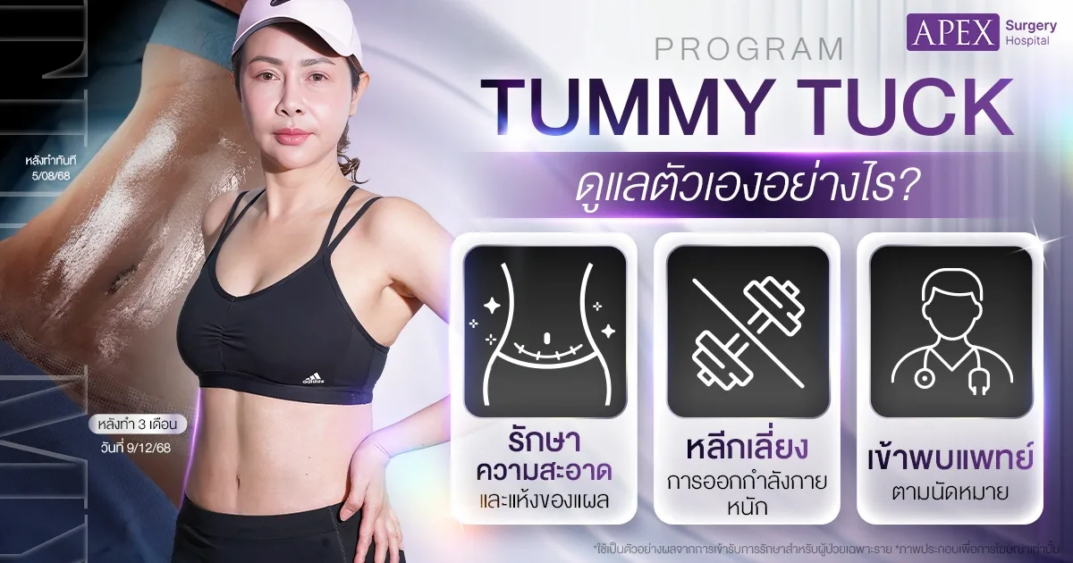 หลังตัดหน้าท้อง Tummy Tuck
