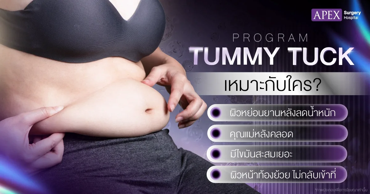 ตัดหนังหน้าท้อง เหมาะกับใคร