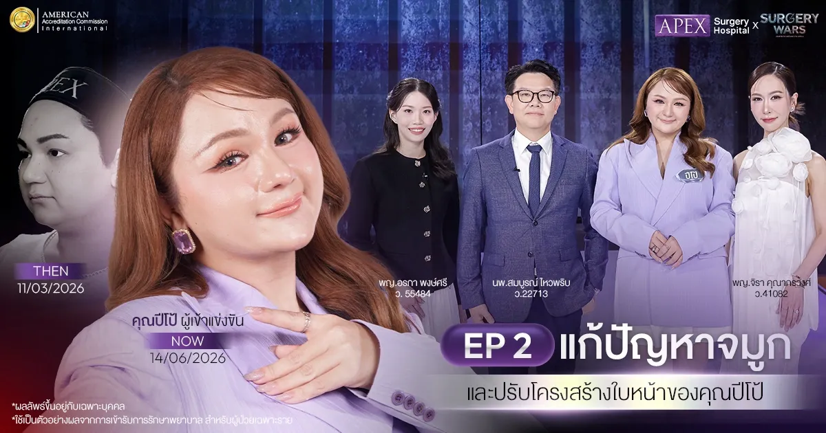APEX Surgery Wars EP2 แก้จมูก ปรับโครงสร้างใบหน้าคุณปีโป้