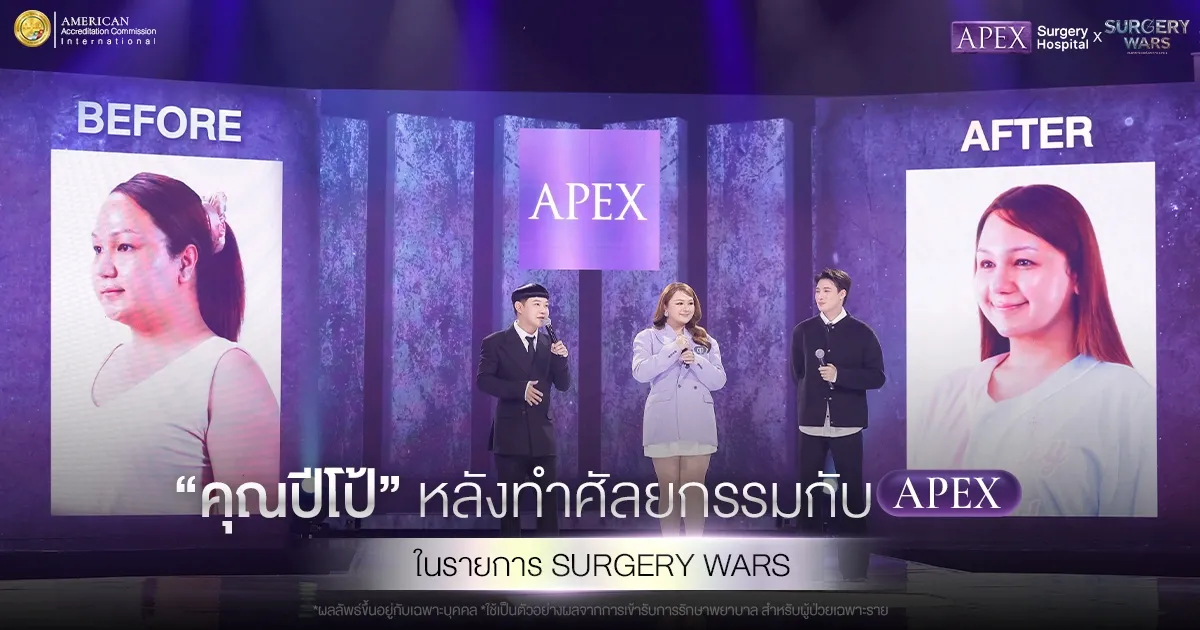 Before After คุณปีโป้ หลังศัลยกรรมกับ APEX ในรายการ Surgery Wars