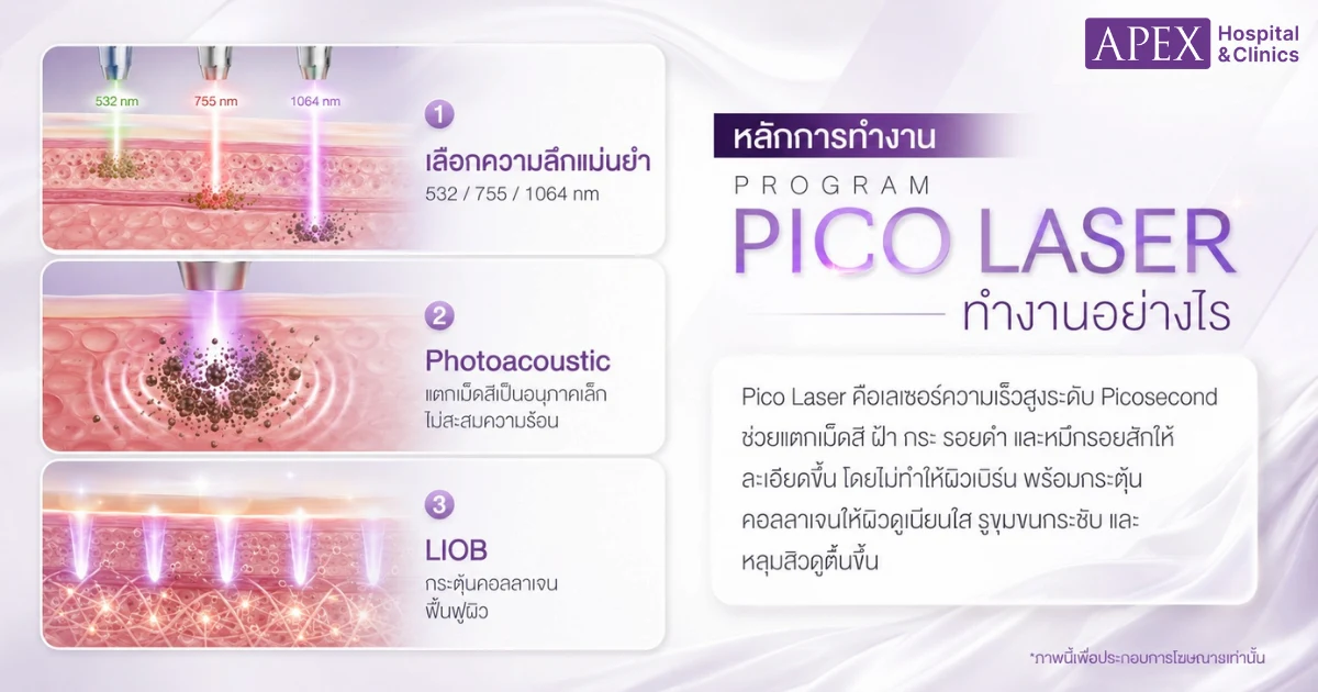 Pico Laser คืออะไร ทำงานอย่างไร