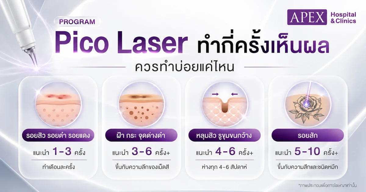 ทำ Pico Laser กี่ครั้งเห็นผล ควรทําบ่อยแค่ไหน