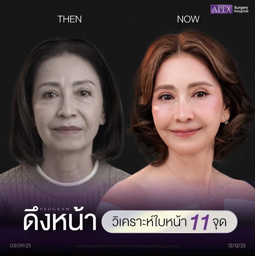 วิเคราะห์ใบหน้า 11 จุด