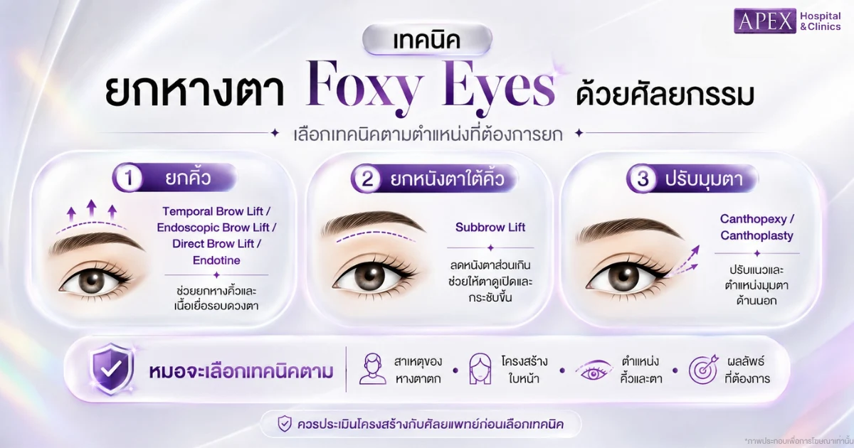 ยกหางตา Foxy Eyes ด้วยศัลยกรรม