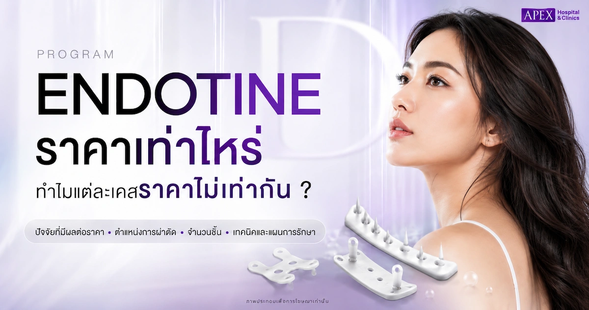 Endotine ราคา