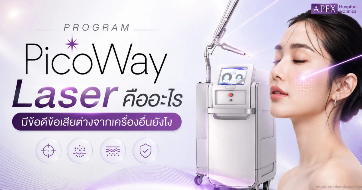 PicoWay