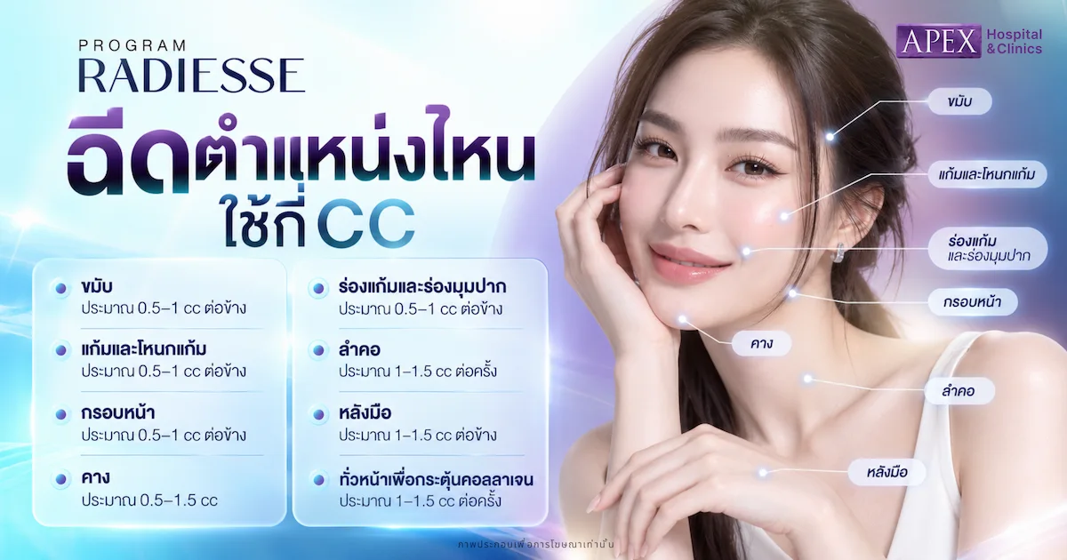 Radiesse ฉีดตำแหน่งไหนได้บ้าง ใช้กี่ CC