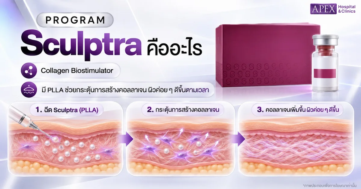 Sculptra คืออะไร
