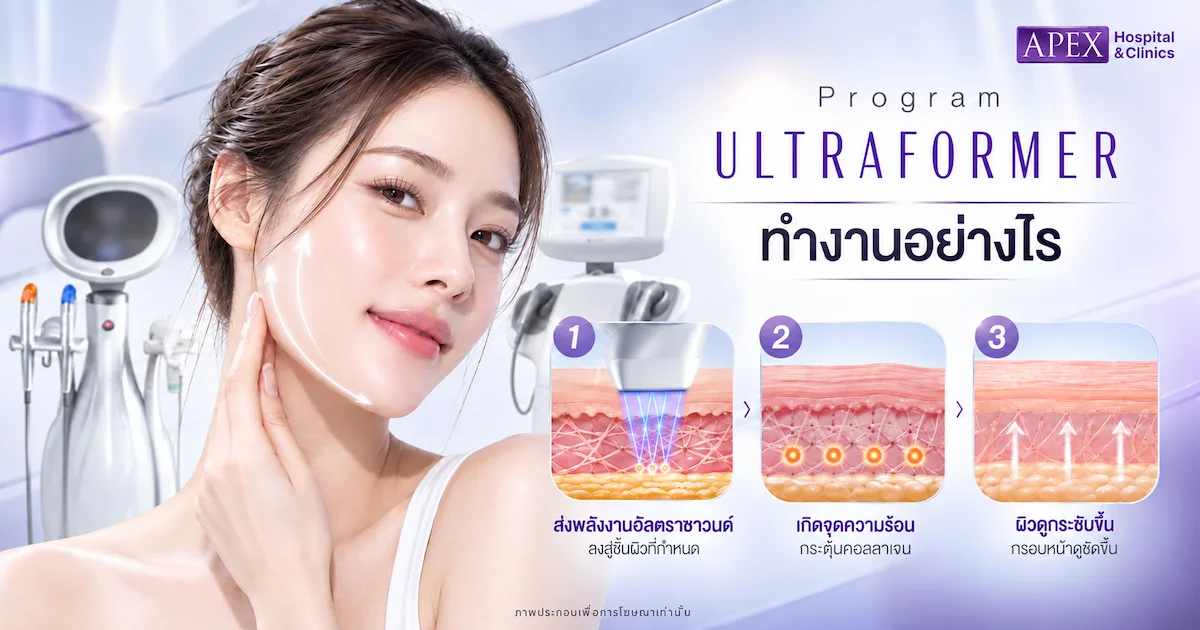Ultraformer ทำงานอย่างไร