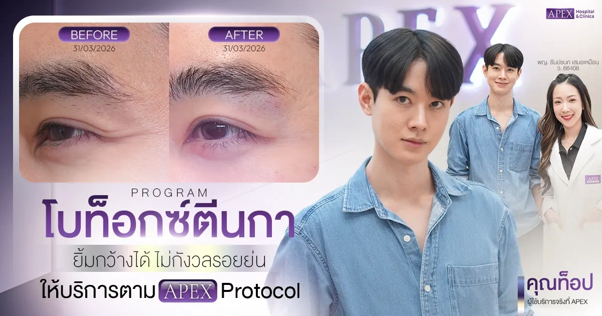 โบท็อกตีนกา
