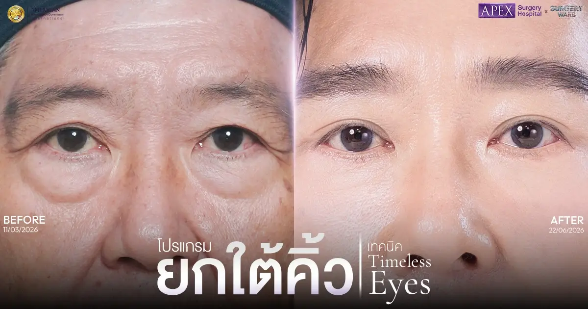 คุณลุงวันชัยทำหัตถการอะไรบ้าง