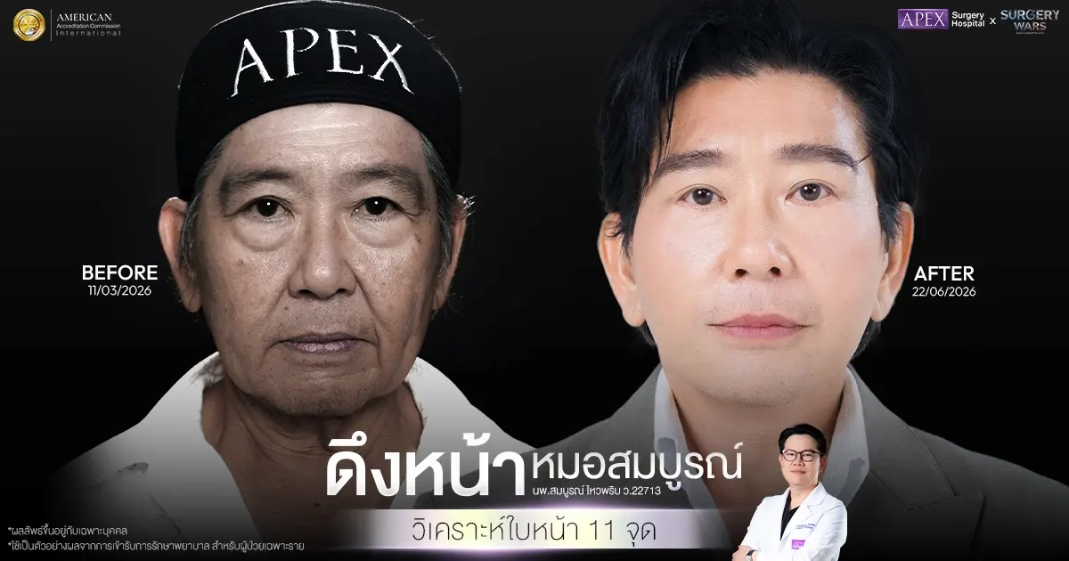 วิเคราะห์ใบหน้า 11 จุด