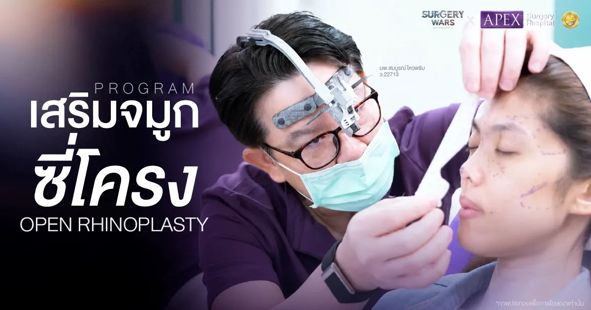 APEX ออกแบบศัลยกรรมเพื่อความสมดุลของใบหน้า