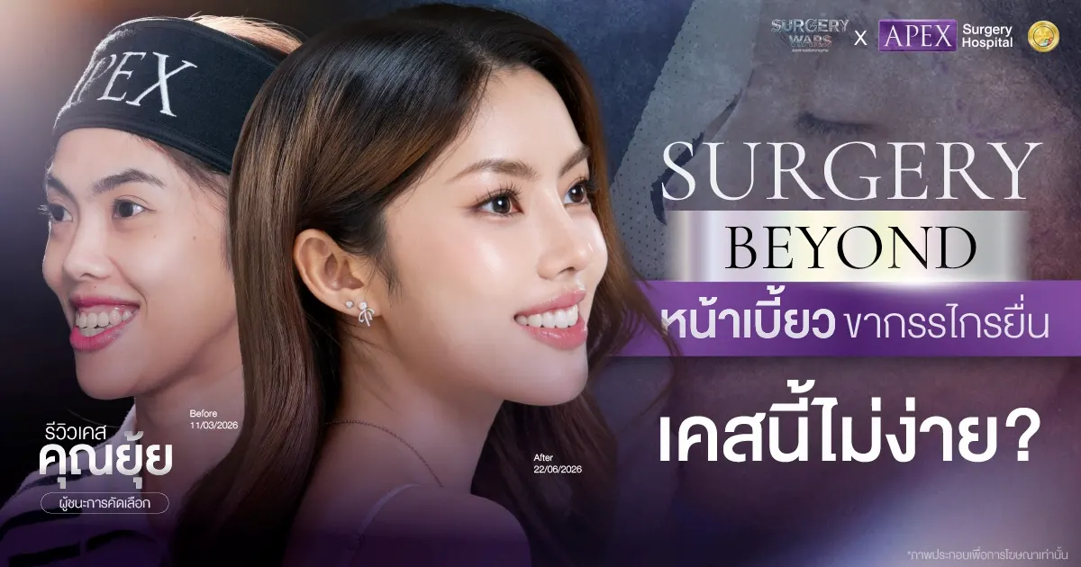 รีวิวเคสคุณยุ้ย